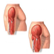 treino de hipertrofia